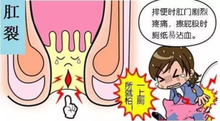 直肠疼痛是怎么回事