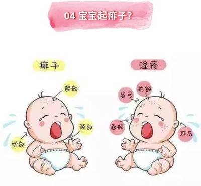 宝宝为什么会湿疹