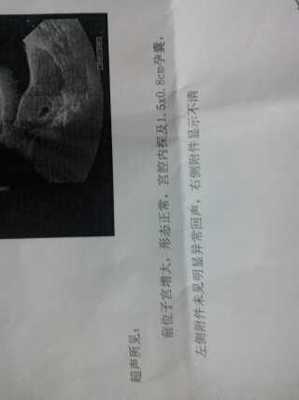 怀孕40天能看出男女吗