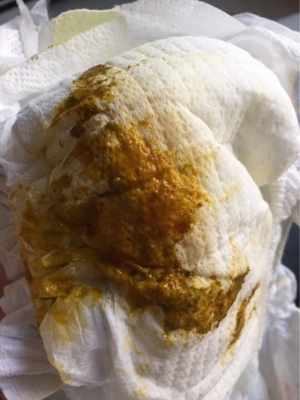 宝宝拉的粑粑黏糊糊的