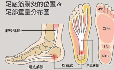 足底疼是怎么回事