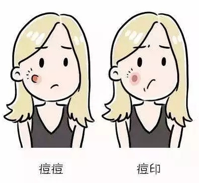 长痘痘是因为缺水吗