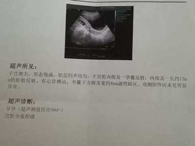 孕酮吃多了对胎儿有影响吗