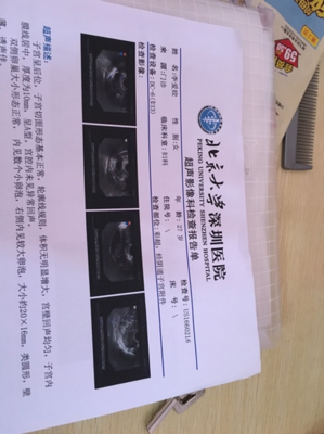多囊怀孕