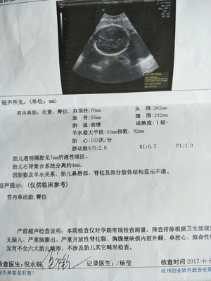 怀孕两周胎儿有多大