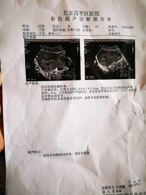 怀孕10周图片
