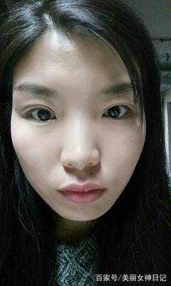 双眼皮如何抽脂