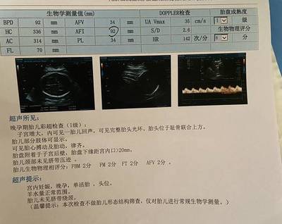 怎么测试男女宝宝最准