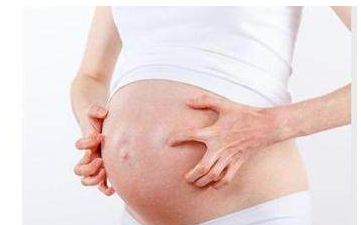 孕妇血糖高有什么症状