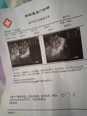 怀孕前会出血吗