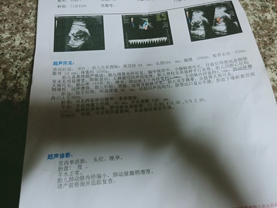 36周宝宝多少斤才正常
