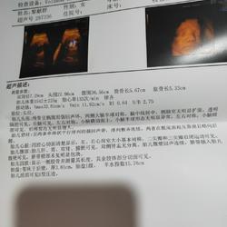 胎儿入盆多久能生