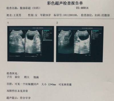 怀孕6周彩超图片