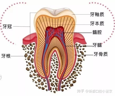 牙神经坏了治一下要多少钱