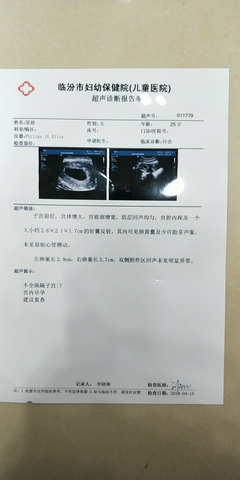 6周妊娠胎心应该多少正常