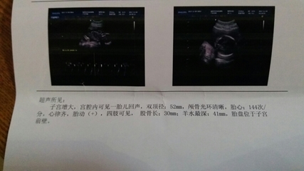 怀孕18周胎儿稳定了吗