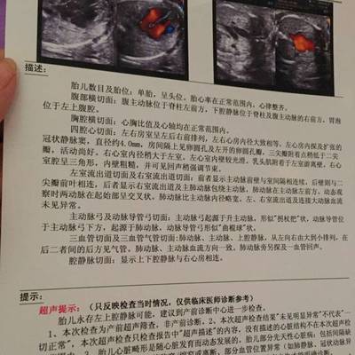 胎儿心脏检查
