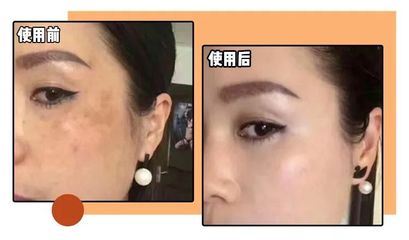 如何使毛孔变细腻