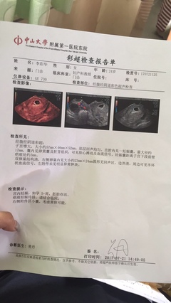 怀孕检测报告单