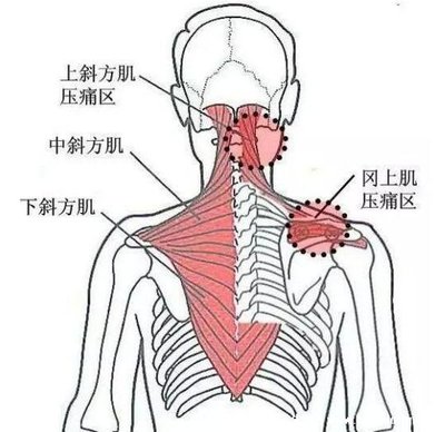 后背胀是怎么回事