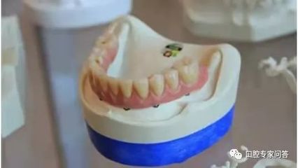 拔牙第二天吃什么