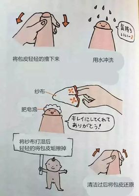 包皮裂口是怎么回事