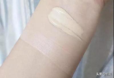 油皮痘痘肌可以用柔肤水吗