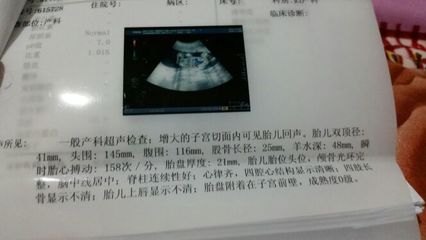孕19周胎儿双顶径标准