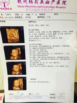 怀孕多久可以鉴定男女