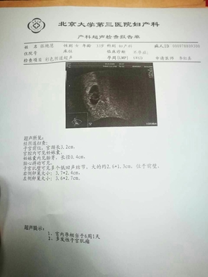 怀孕21天能看到孕囊吗