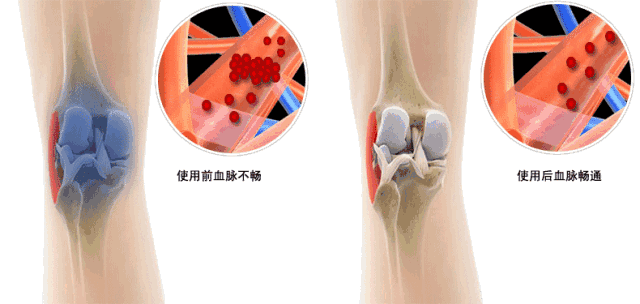 膝关节累是怎么回事啊