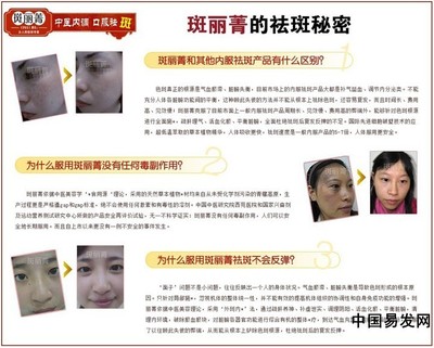 祛斑有什么副作用