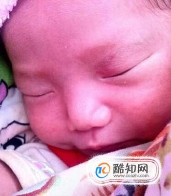 新生儿鼻子有白点怎么回事