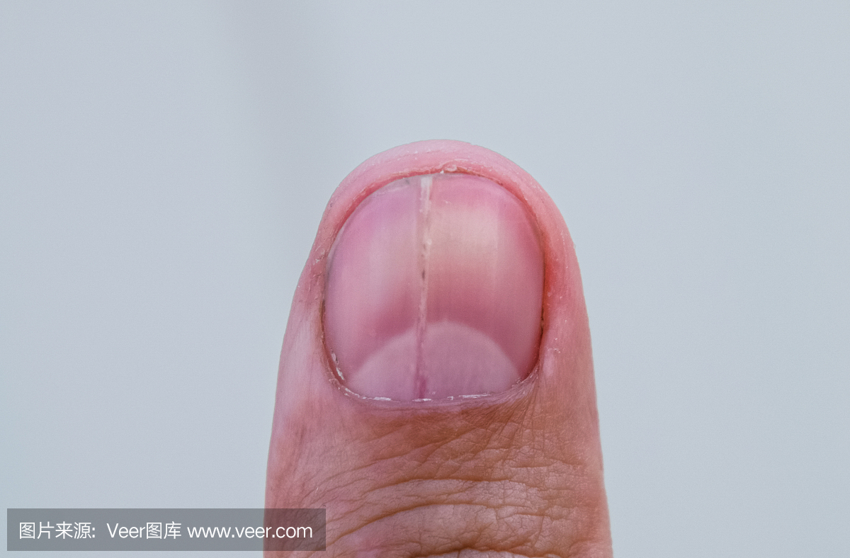 大拇指指甲宽约多少亳米
