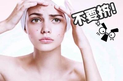 脸上好多痘痘怎么去除