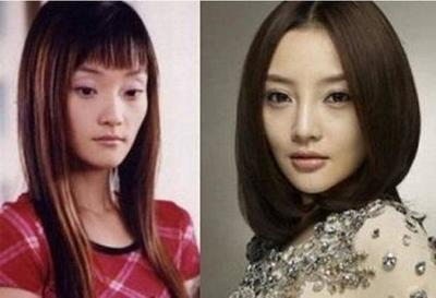 女明星的双眼皮