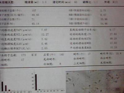 前列腺会怀孕吗