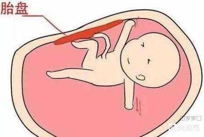 孕妇能做彩超吗
