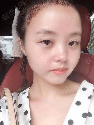 做梦头发掉光