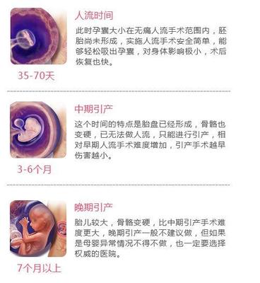 3个月可以药流吗