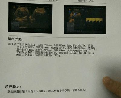 怀孕梦见石榴