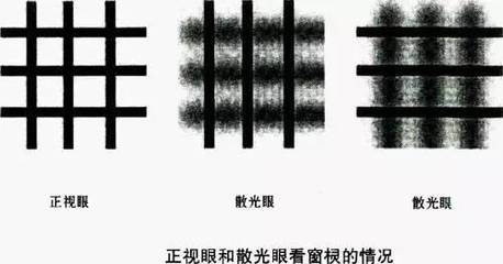 看东西有重影是怎么回事