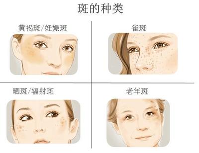 脸上的痘痘有什么分类