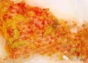 宝宝血便图片