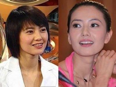 牙套会改变脸型吗