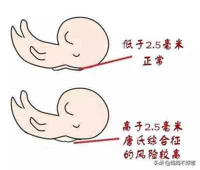 孕妇多少周有胎动
