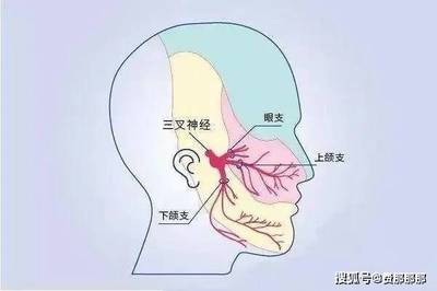三叉神经疼是怎么回事