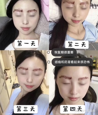 纹眉第四天