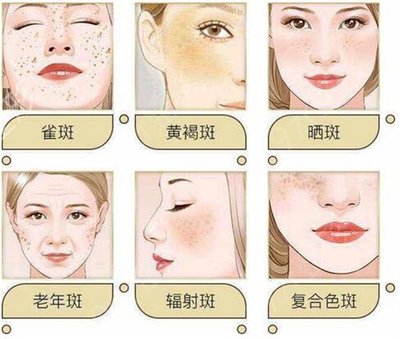 眼皮上长痘怎么办