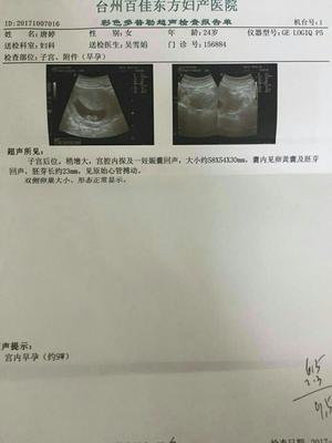 台州东方妇产科做b超多少钱